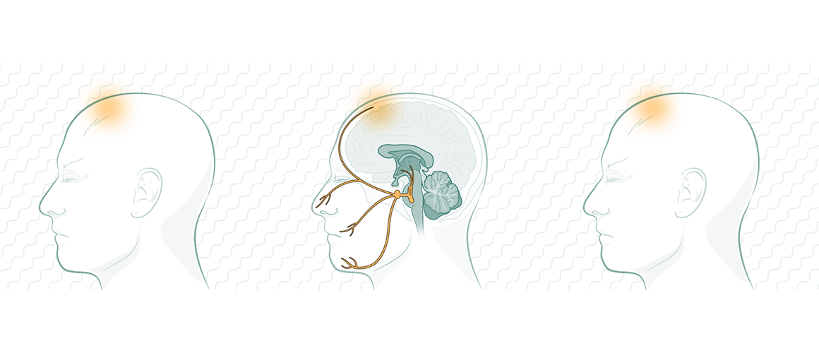 Modern_Understanding_of_the_Pathophysiolog_of_Migraine_1160x500.png